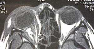 Radiologic Studies